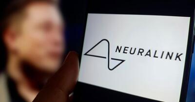 بروز مشکلات فنی در ایمپلنت مغز انسان شرکت Neuralink