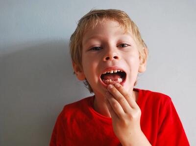 دندان شیری کی می‌ افتد؟ + ترتیب افتادن دندان شیری کودکان
