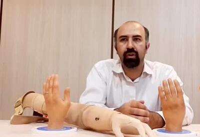 ایرانی‌ کاردرستی که برای خودش انگشت و دست مصنوعی ساخت