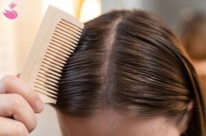 بهترین درمان ریزش مو خانگی