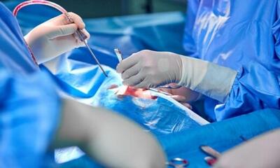 جراحی قطع تشنج کودکان در دانشگاه علوم پزشکی ایران/ بی‌نیازی از اعزام بیمار به ژاپن