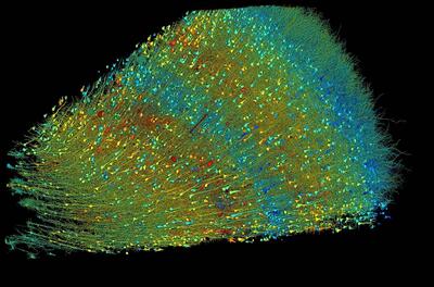 جهانی در یک دانه برنج؛ دانشمندان جزئیات بی سابقه ای از مغز انسان را به تصویر کشیدند + تصاویر | پایگاه خبری تحلیلی انصاف نیوز