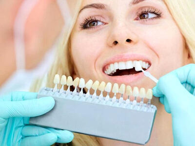 آیا لمینت دندان دائمی است؟ بررسی ماندگاری لمینت دندان