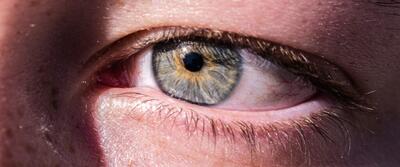 گاردین: محققان در مورد عمل تغییر رنگ چشم هشدار می‌دهند | خبرگزاری بین المللی شفقنا