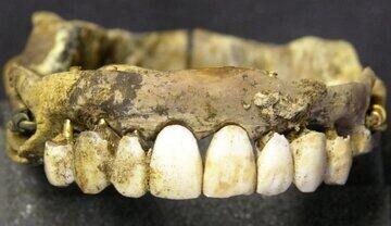 منشأ چندش‌آور دندان‌های مصنوعی فاش شد! | روزنو