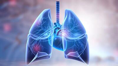ایمونوتراپی قبل و بعد از جراحی بقای سرطان ریه را افزایش می دهد