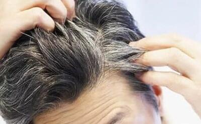 کندن مو‌های سفید خطر ابتلا به زخم و عفونت را افزایش می‌دهد
