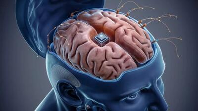 نورالینک مجوز FDA برای دومین جراحی کاشت تراشه در مغز انسان را دریافت کرد