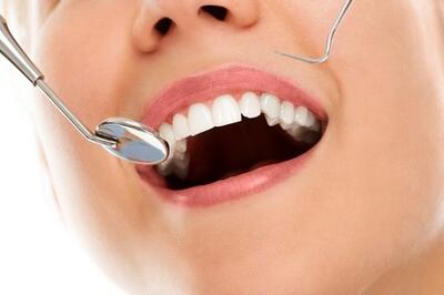 %10تخفیف روکش دندان با جدید ترین متد|دکتر کوروش صادقی