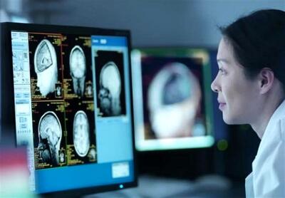 مغز انسان تا ۱۰ دقیقه بعد از مرگ فعال است! +فیلم