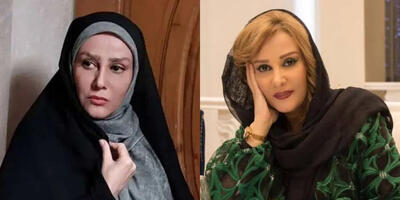 تغییر چهره این بازیگر ایرانی سوژه شد