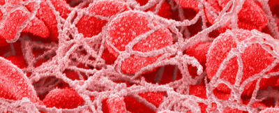 دست میکروپلاستیک‌ها در لخته شدن خون در کار است!