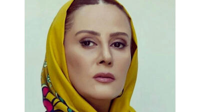 این خانم بازیگر  ملکه عمل زیبایی ایران لقب گرفت!  / شیوا خسرو مهر در پیری جوان و زیبا شد !