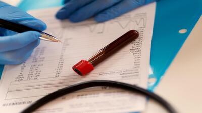 آموزش خواندن برگه جواب آزمایش خون| جدول تفسیر آزمایش خون کامل