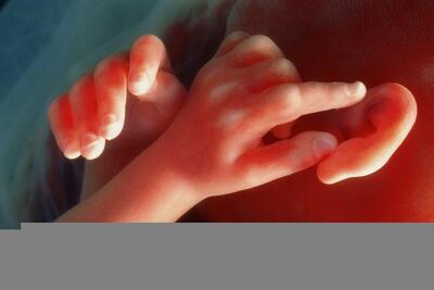 محافظت از نوزادان پیش از تولد با فناوری «جفت روی یک تراشه»