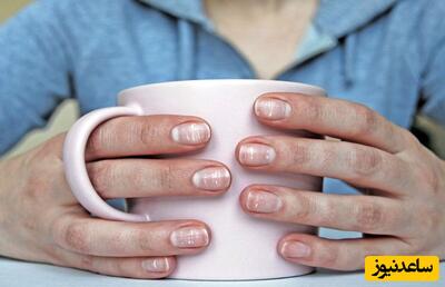 علت به وجود آمدن لکه‌ی سفید روی ناخن و روش‌های درمان آن