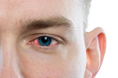 نگهداری از سلامت چشم‌ ها با روش‌های ساده و در دسترس: از شستشو تا کمپرس