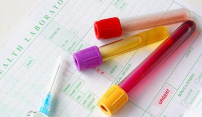 آزمایش خون بارداری چیست؟ + روش انجام آن در منزل