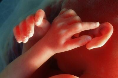 محافظت از نوزادان پیش از تولد با فناوری «جفت روی یک تراشه»