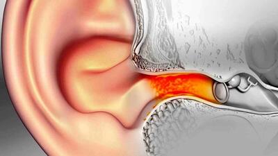 چند راهکار ساده و موثر برای تمیز کردن گوش ها
