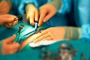 انجام بیش از ۵۶۰ هزار عمل جراحی رایگان در سال گذشته