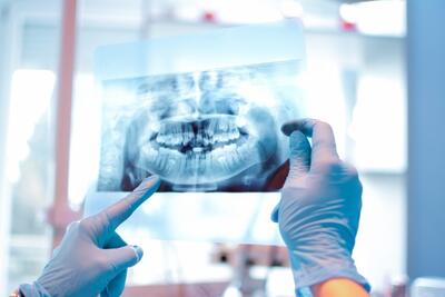 اولین «داروی رشد مجدد دندان» در جهان وارد فاز آزمایش بالینی می‌شود
