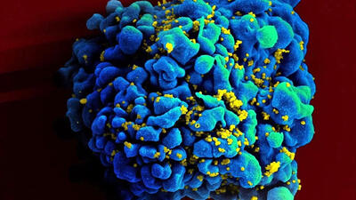 خبر خوش از بیماری ایدز/ واکسن ایدز ساخته شد