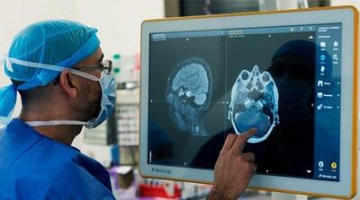 بهره‌مندی بیش از ۳ هزار نفر از خدمات تصویربرداری MRI درمراکز تحت پوشش دانشگاه