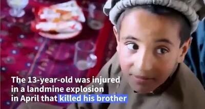 هر روز یک کودک قربانی دهه‌ها جنگ در افغانستان + فیلم