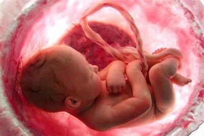 چه عواملی موجب سقط خودبه‌خودی جنین می‌شود؟