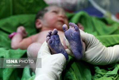 از هر یک‌هزار تولد زنده در استان سه نوزاد مبتلا به کم‌کاری تیروئید، شناسایی و درمان شده‌اند