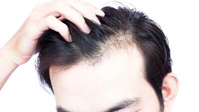 بیوتین به رشد مو کمک می‌کند