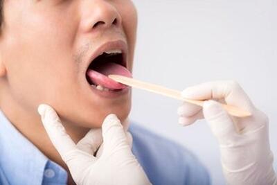 کبودی زبان نشانه کدام بیماری است؟