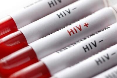 خداحافظی با ایدز؛ موفقیت واکسن آزمایشی «اچ. آی. وی» در بدن