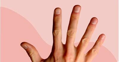 ابتلا به سرطان از ناخن‌های دست قابل تشخیص است