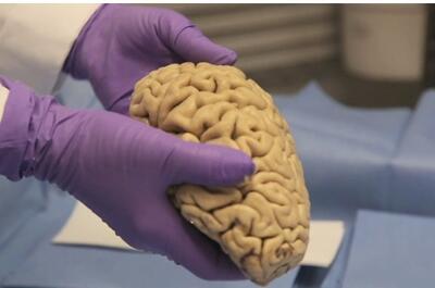 دستاوردی ترسناک درباره مغز انسان بعد از مرگ!