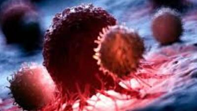 درمان سرطان مغز با ویروس آبله/ ویروسی که سلول‌های سرطانی را از بین می‌برد
