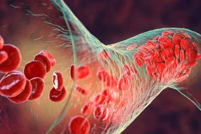میکروپلاستیک‌ها به لخته‌های خونی قلب، مغز و پاهایمان نفوذ کرده‌اند - زومیت