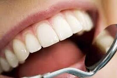 داروی رشد مجدد دندان آماده آزمایش روی انسان شد
