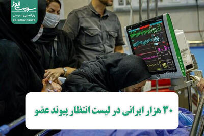 30 هزار ایرانی در لیست انتظار پیوند عضو