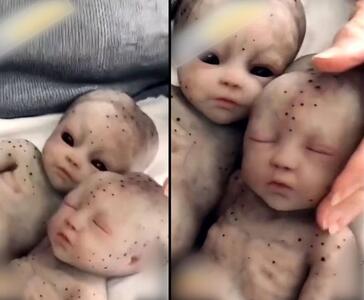 نوزاد وحشناکی با 3 صورت و 2 چشم به دنیا آمد! +ویدئو