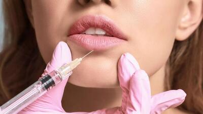 درمان‌های زیبایی؛ فرانسه قوانین تزریق هیالورونیک اسید را سخت‌تر می‌کند
