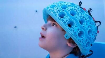 واضح ترین تصویر از مغز در حال رشد کودکان ارائه شد