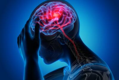 افزایش خطر سکته مغزی در این شب‌ها | اقتصاد24