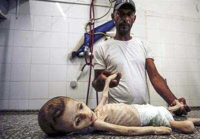 جنگ اسرائیل با کودکان؛ تراژدی دردناک مرگ براثر گرسنگی در غزه