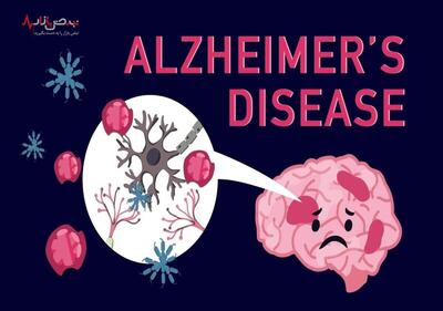 رازهای ساده برای سلامت ذهن و پیشگیری از آلزایمر