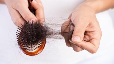 مهم‌ترین عوامل ریزش موی سر در زنان