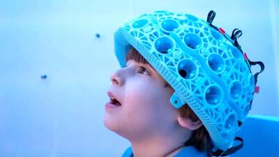 درمان اوتیسم با اسکنر پوشیدنی، نقشه فعالیت مغز کودکان ثبت می شود