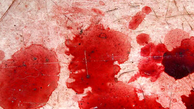 جنایت دهه هشتادی ها درپارک رازی !/ گزارش چهارمین نزاع خونین در 48 ساعت