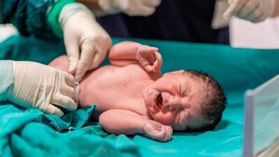 ‌غربالگری ۱۰۰درصدی نوزادان در فارس